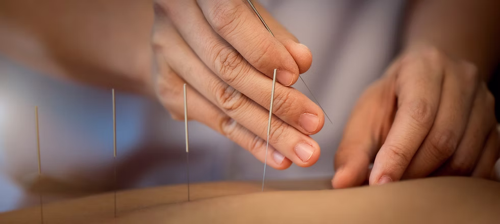 Neck Pain: What Traditional Chinese Medicine Can Do For You
